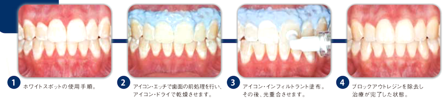 アイコン治療法