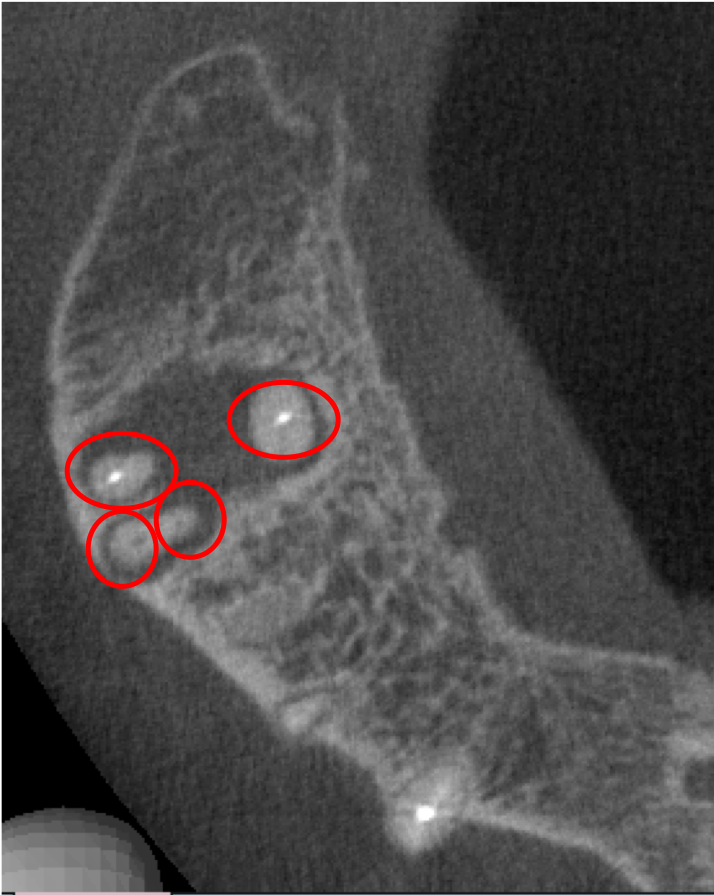 歯科用CT