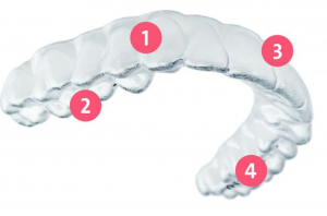 マウスピース矯正南小岩の歯医者 小野寺歯科医院 南小岩の歯医者 小野寺歯科医院